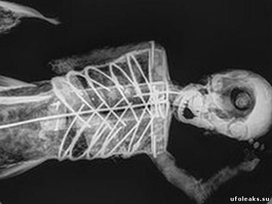 Рентген мумии русалки